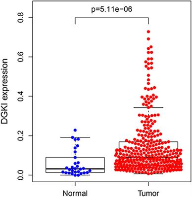 Overexpression of DGKI in Gastric Cancer Predicts Poor Prognosis